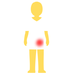 A person with no hair or face, an emoji yellow skintown, and a white pair of shorts and pants with no visible divider between the two. there's a glowing red spot on their pelvis.